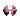 Pulmonary embolism
